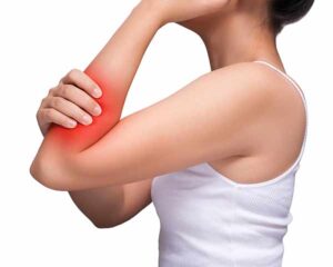 Woman holding arm showing complex regional pain syndrome and treatment at Shoreside Interventional Pain in Sarasota, FL.