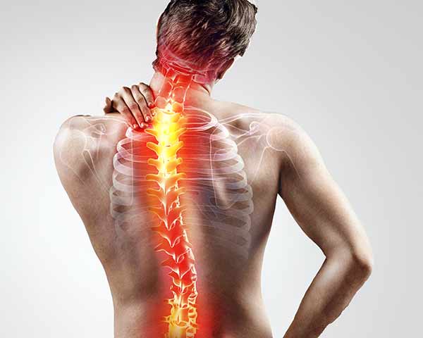 Failed back surgery treatment at Shoreside interventional Pain in Sarasota Florida.