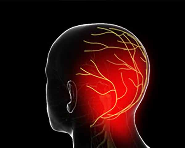 Occipital nerve block for pain management in sarasota, fl.