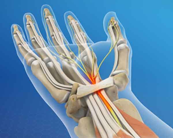 peripheral nerve block for pain management.
