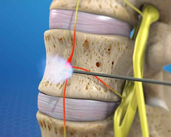 Pain management Sarasota, Florida.